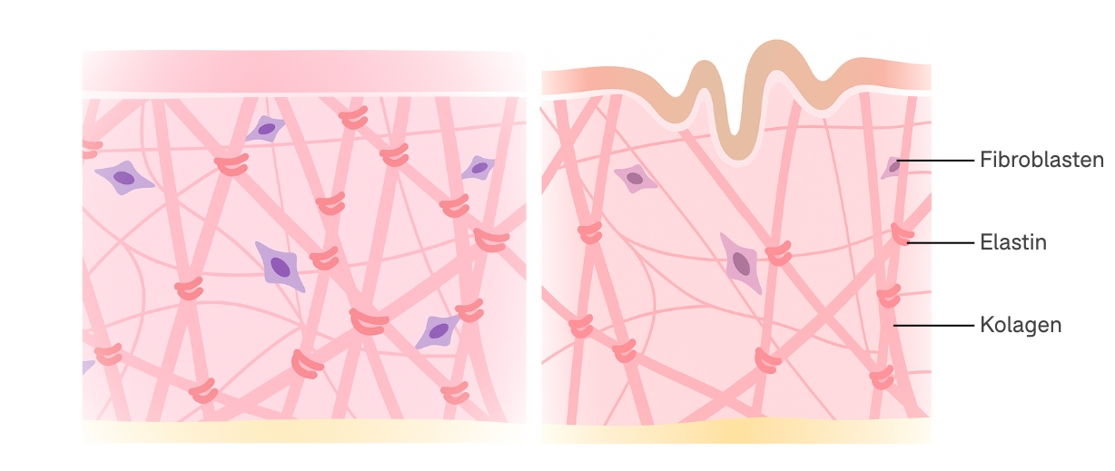 Eine Infografik zeigt den Querschnitt der Haut und der darin vorkommenden Fibroblasten, die wie kleine Zellen aussehen, Kollagen- und Elastinfasern, die sich kreuz und quer durch die Haut ziehen.