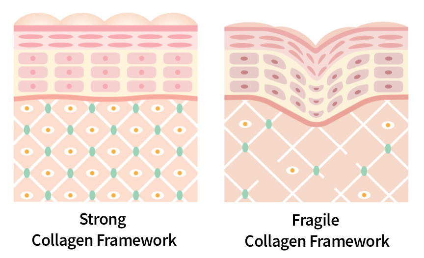 A strong and brittle collagen framework and how wrinkles form