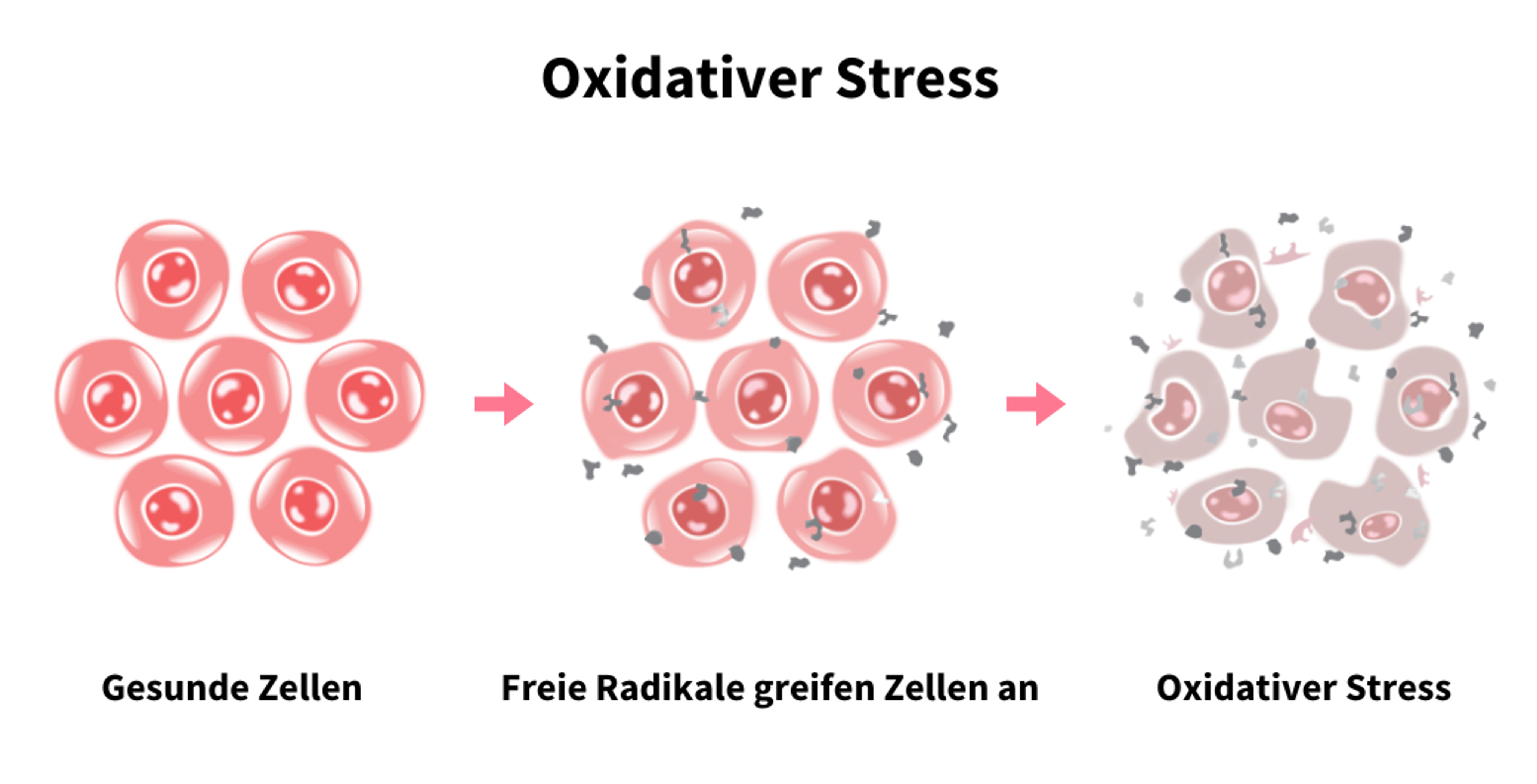 Illustration zum Prozess von oxidativem Stress: Links gesunde, intakte Zellen in kräftiger Lachsfarbe, in der Mitte Zellen, die von freien Radikalen angegriffen werden, rechts beschädigte Zellen durch oxidativen Stress, die mittlerweile verformt und gräulich geworden sind.