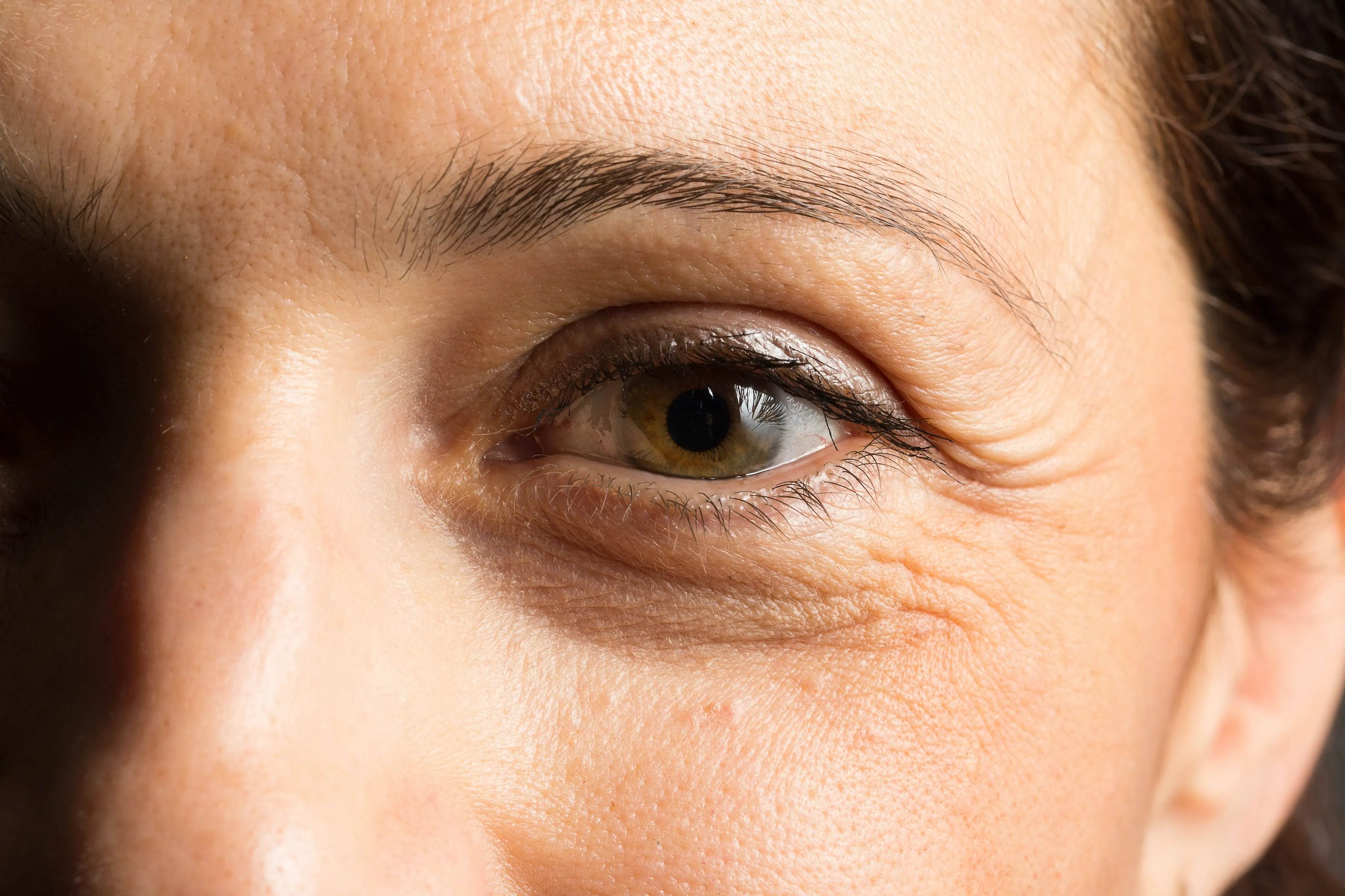 Falten um die Augen 