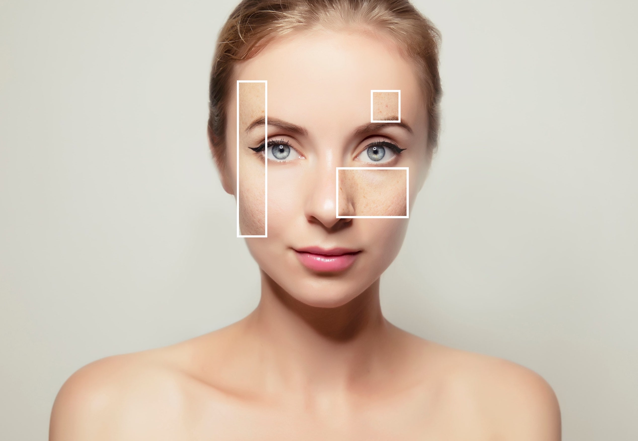 Vitamin C gegen Pigmentflecken